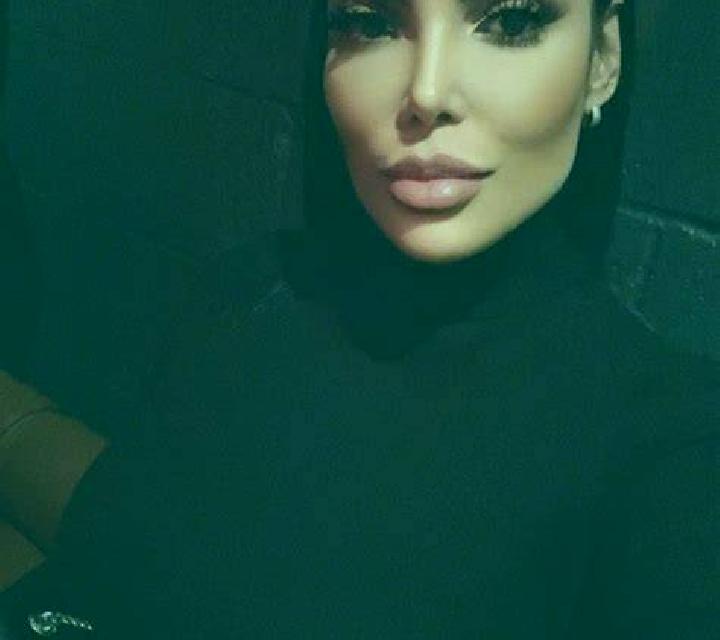 Cony 3 Los Laureles escort